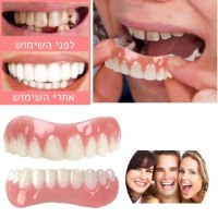 ציפוי-שיניים-וחניכיים-לבנות