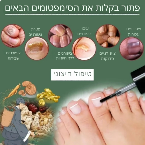פטרת-ציפורניים-רגליים