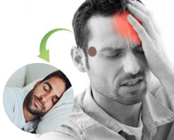 מדבקות חדשניות להקלה מידית בכאבי ראש ומיגרנות