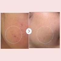ערכת טיפוח קוריאנית מבית Medicube על בסיס זרע סלמון טהור (PDRN) פפטידים ורטינול