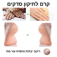 קרם לטיפול בסדקים ויובש