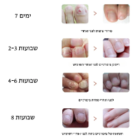 Magic stickers-מדבקות ג'ל לטיפול בפטרת