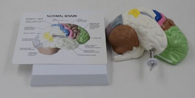 בהזמנה מראש: דגם אנטומי 6121 - חתך מוח אנושי צבעוני בגודל טבעי על סטנד
