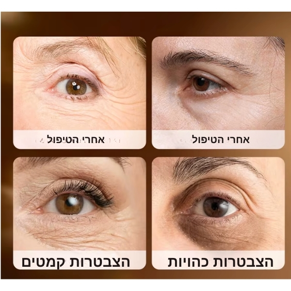 מסכות טיפול לעיניים קפאין וקולגן להעלמת כהויות ונפיחות SADOER