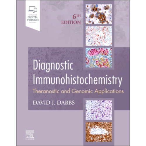 Diagnostic Immunohistochemistry : Theranostic and Genomic Applications