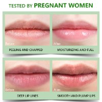 שפתון טיפולי (ליפ באלם) אינטנסיבי לשפתיים