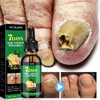שמן לטיפול בפטרת ציפורניים NailCare