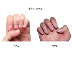 שמן טיפולי ליובש בציפורניים- SilkNail