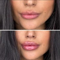 גלוס לניפוח השפתיים מבית LippyPop למראה שפתיים עבות ומלאות - מפיץ רשמי בישראל
