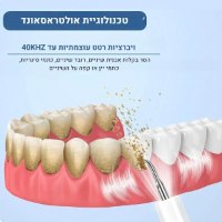 ניקוי-אבנית-בשיניים-מכשיר-שימוש-אישי