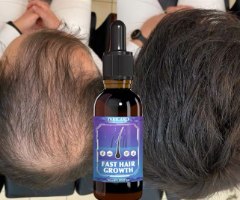 שמן הזנה להחזרת פיגמנט צבע לשיער