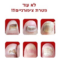 שמן לטיפול בפטרת ציפורניים NailCare