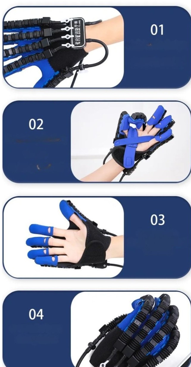 מכשיר שיקומי לתנועת היד