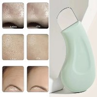 כלי Blackhead חדשני להסרת שחורים, קומדונים, שומן ולכלוך עמוק מהעור- טיפול לאקנה ולעור בריא וזוהר