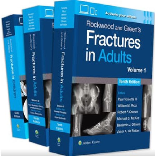 Rockwood Fractures Package - Adults and Children