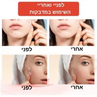 עור-פנים-פצעים