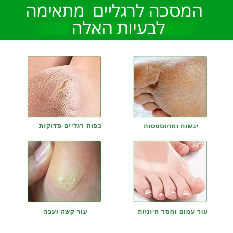 תוצאות מסכת הפילינג