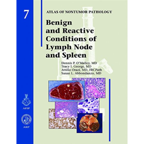 Benign and Reactive Conditions of Lymph Node and Spleen - Atlas of Non-Tumor Pathology, Series 1
