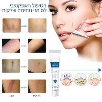 קרם המסייע לסימני מתיחה