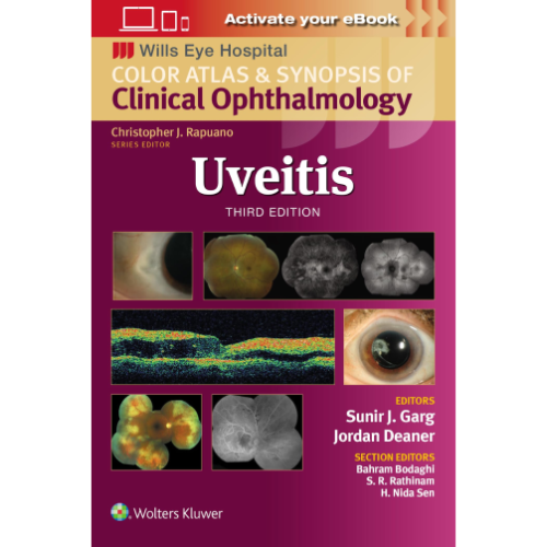 Uveitis (Wills Eye Institute Atlas Series)