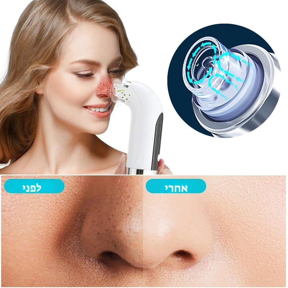 מכשיר להסרת נקבוביות