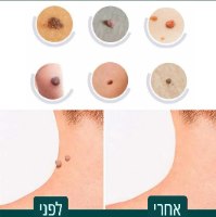 מדבקות להסרת סרחי עור