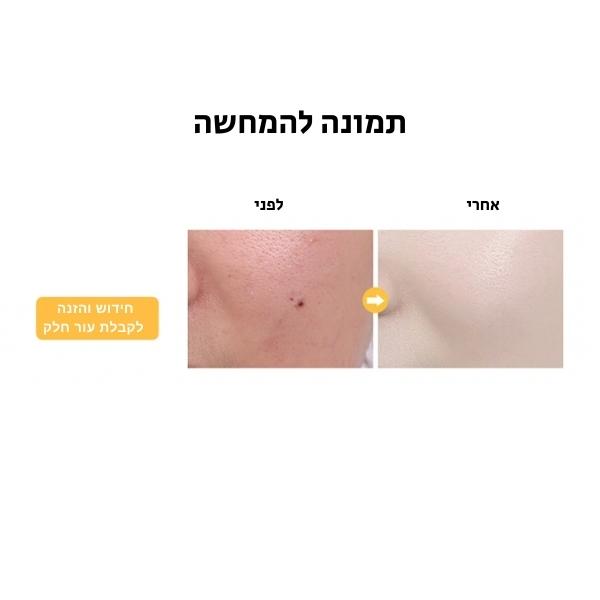 סרום-מומלץ-חומצה-היאלורונית