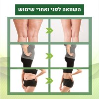 מדבקות-הרזיה-הפחתת-הורדת-צלוליטיס