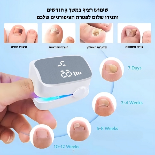 מכשיר-לייזר-ביתי-לטיפול-בפטרת-ציפורניים-נייד
