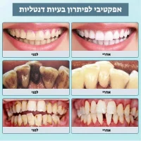 מכשיר-ביתי-לניקוי-אבנית-בשיניים