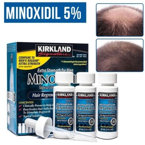 מינוקסידיל 5% - שמן מונע נשירת שיער