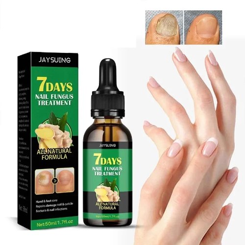 שמן לטיפול בפטרת ציפורניים NailCare