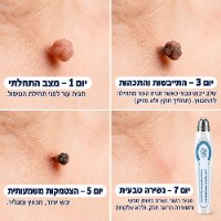 תכשיר רול-און מתקדם להסרת יבלות וסרחי עור מבית ClearTouch