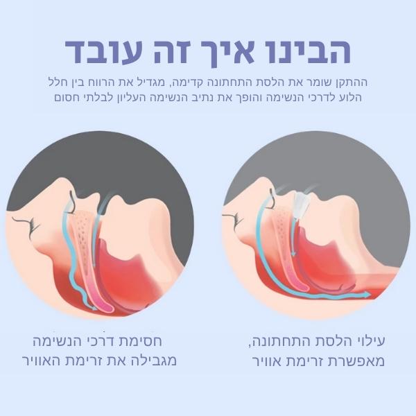 התקן-דנטלי-מקצועי-מכשיר-מונע-נגד-נחירות