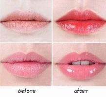 שפתון מנפח ויטמין E וחומצה היאלורונית