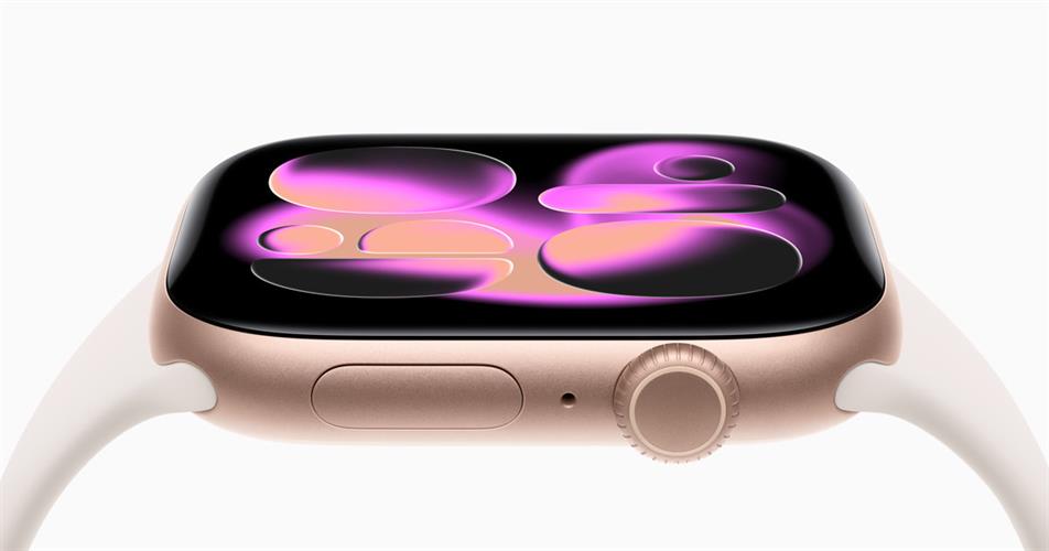 Apple Watch Series 11 42mm GPS - אחריות יבואן DCS