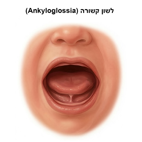 לשון קשורה
