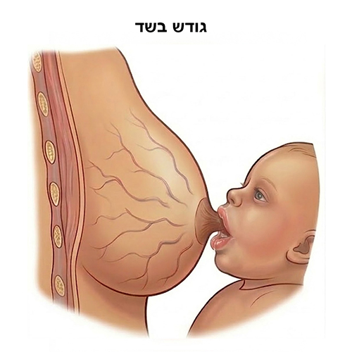 גודש בשד
