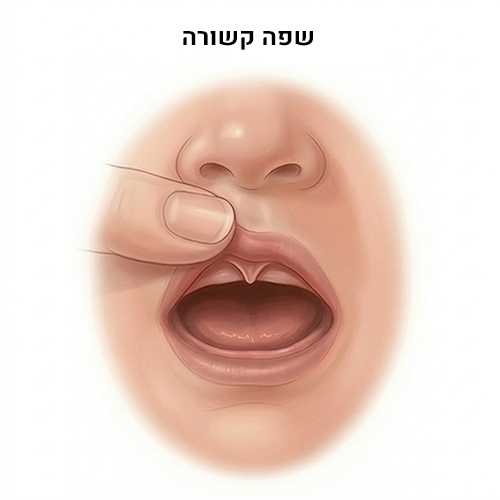 שפה קשורה