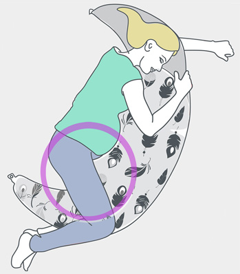 בתמונה איור של אישה שוכבת בחיבוק עם כרית הריון. מסומן  אזור האגן והירך שמושפעים מסימפזיוליזיס