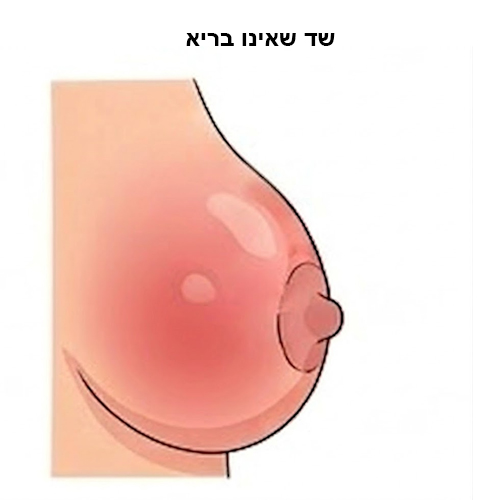 שד שאינו בריא