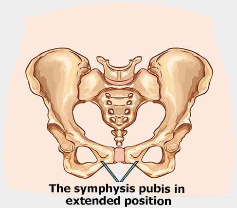 What is symphysiology? An image demonstrating the symphysis pubis joint in the pelvis in an extended position