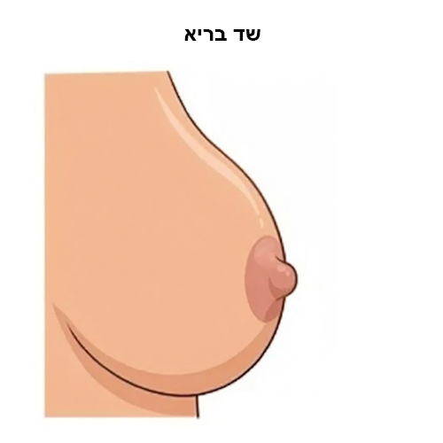 שד בריא