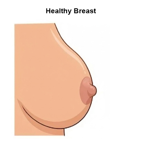 healty Breast