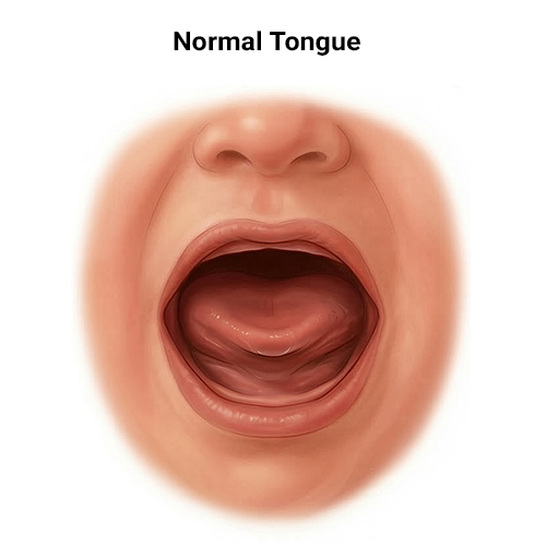 normal tongue
